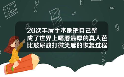 20次丰唇手术她把自己整成了世界上嘴唇最厚的真人芭比玻尿酸打微笑唇的恢复过程图